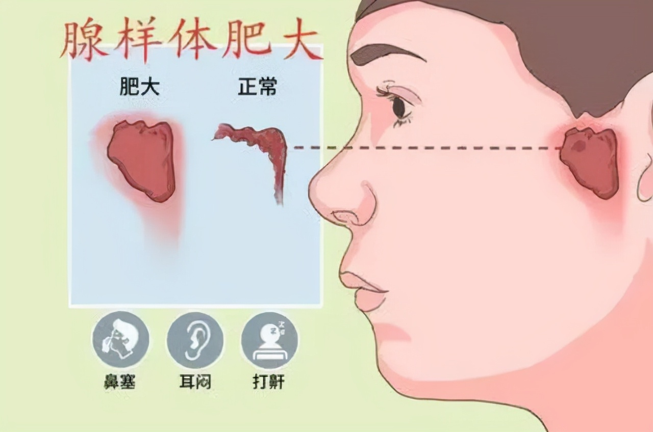 经常鼻塞是癌细胞在作祟？提醒：这3个原因，别轻易忽视了