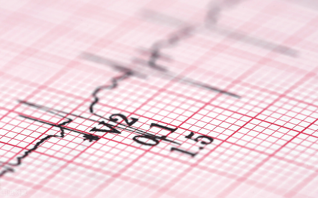 心脏不舒服，心电图、心脏彩超、心脏冠脉造影，哪个检查更好？
