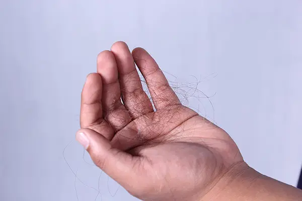 2.5亿人快秃了，用米诺地尔能生发、防脱？是真的，但没这么简单
