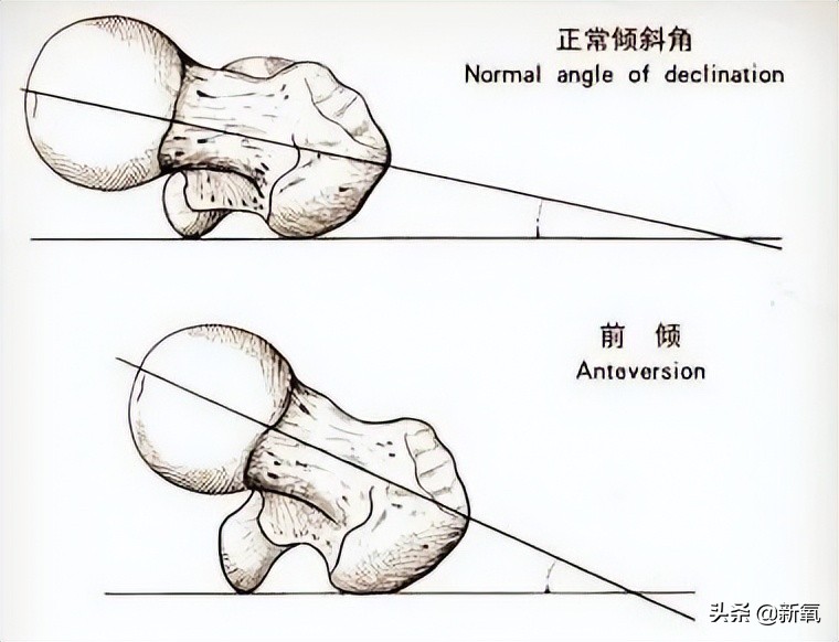 他俩都甜到被怀疑是绯闻变前任了，怎么还有人注意到她肚子没收住