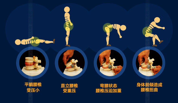 80%的腰椎间盘突出症，靠这4种方法能缓解