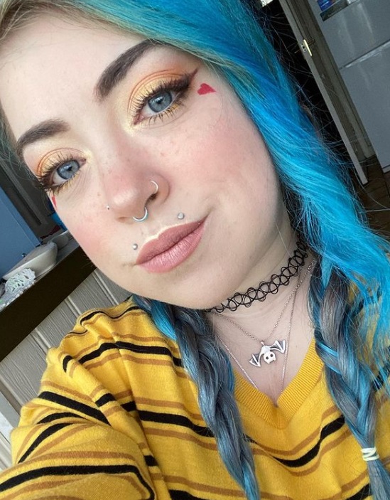 28岁侏儒症女星伯克轻生过世，未婚夫心碎发文：不敢置信