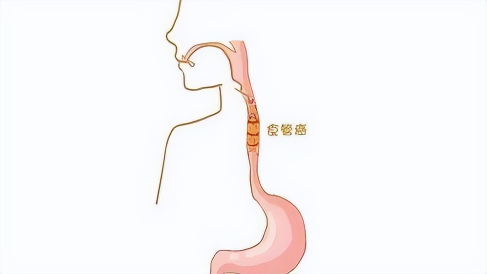 白开水放凉后堪比“慢性毒药”？常喝65℃的水会致癌？实验告诉你