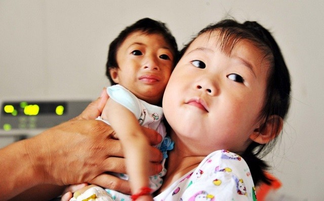 2009年，湖南女子生下重2斤“小猴子”，坐出租车被拒载：坐不下