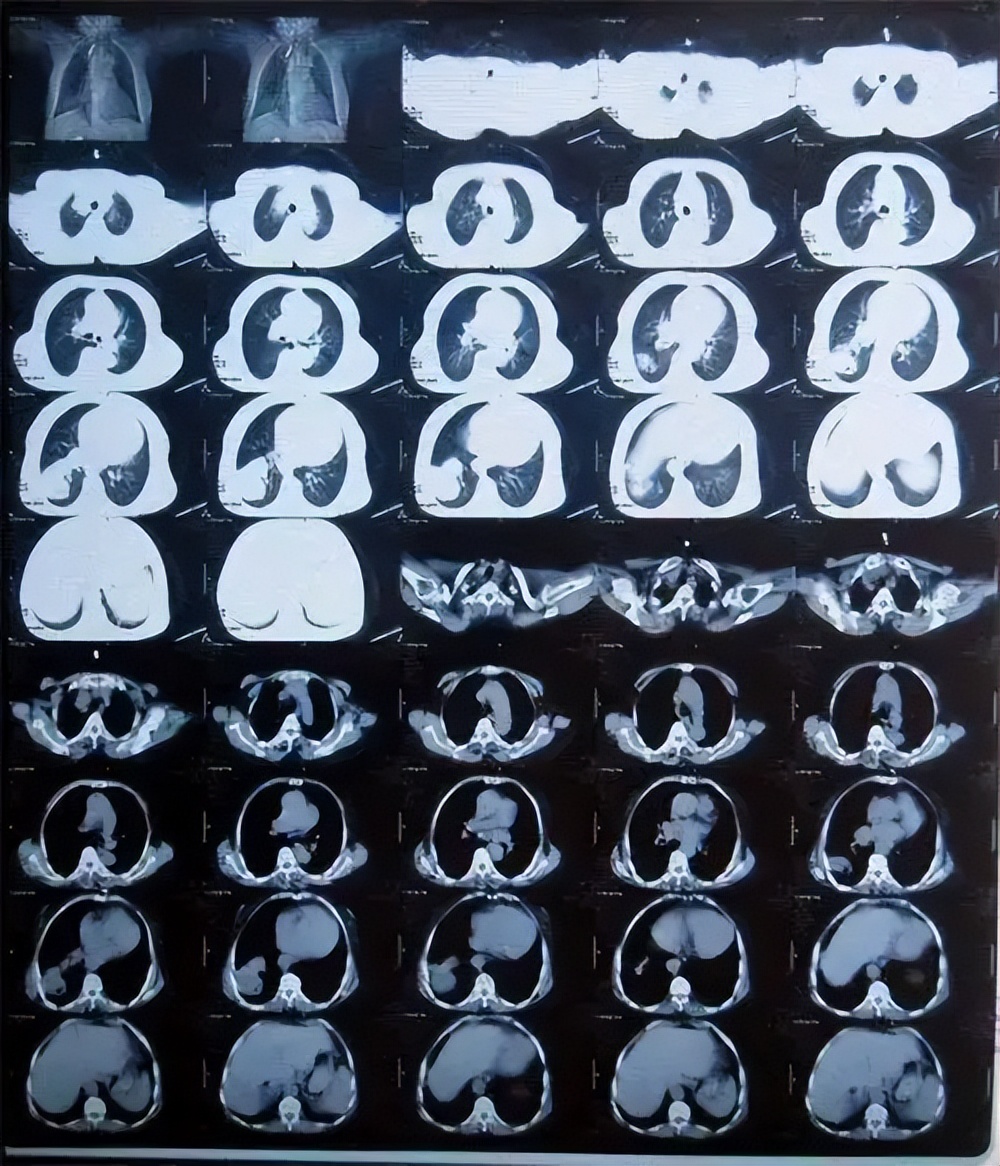 北大婦兒醫院需要多少錢核磁(MRI)到底有什么區別?的簡單介紹