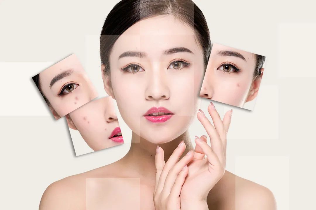 角质太厚的人脸部图片(护肤) - 赤虎壹号