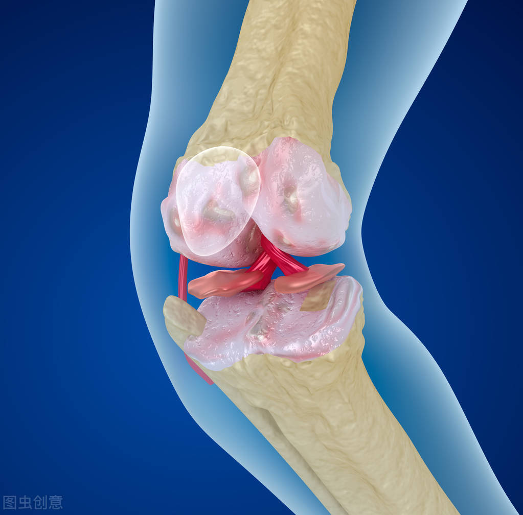 强筋健骨片（介绍3种治疗骨质疏松的中成药）