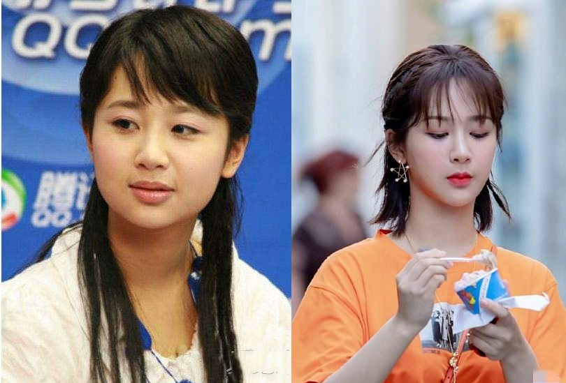 颜值忽高忽低、脸部时好时坏，这些灵动的女明星，都被医美坑惨了