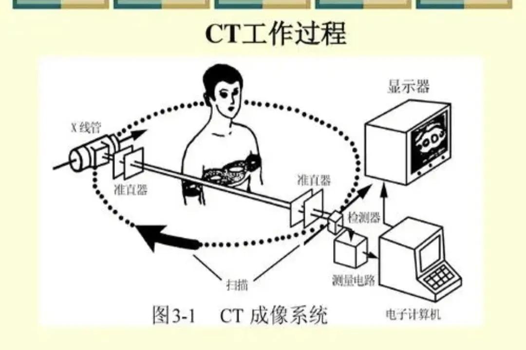 做CT还是做磁共振，不要傻傻分不清？哪些人不能做“磁共振”