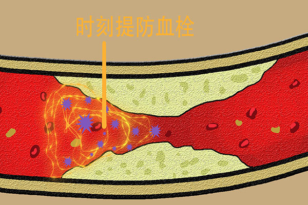 血管堵塞，睡觉时有“信号”，频繁有2种异样，及时关注检查下