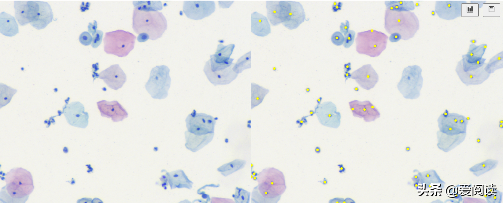 你试过吗？图像（细胞）分割