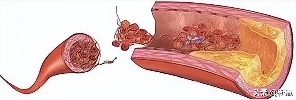 他俩都甜到被怀疑是绯闻变前任了，怎么还有人注意到她肚子没收住
