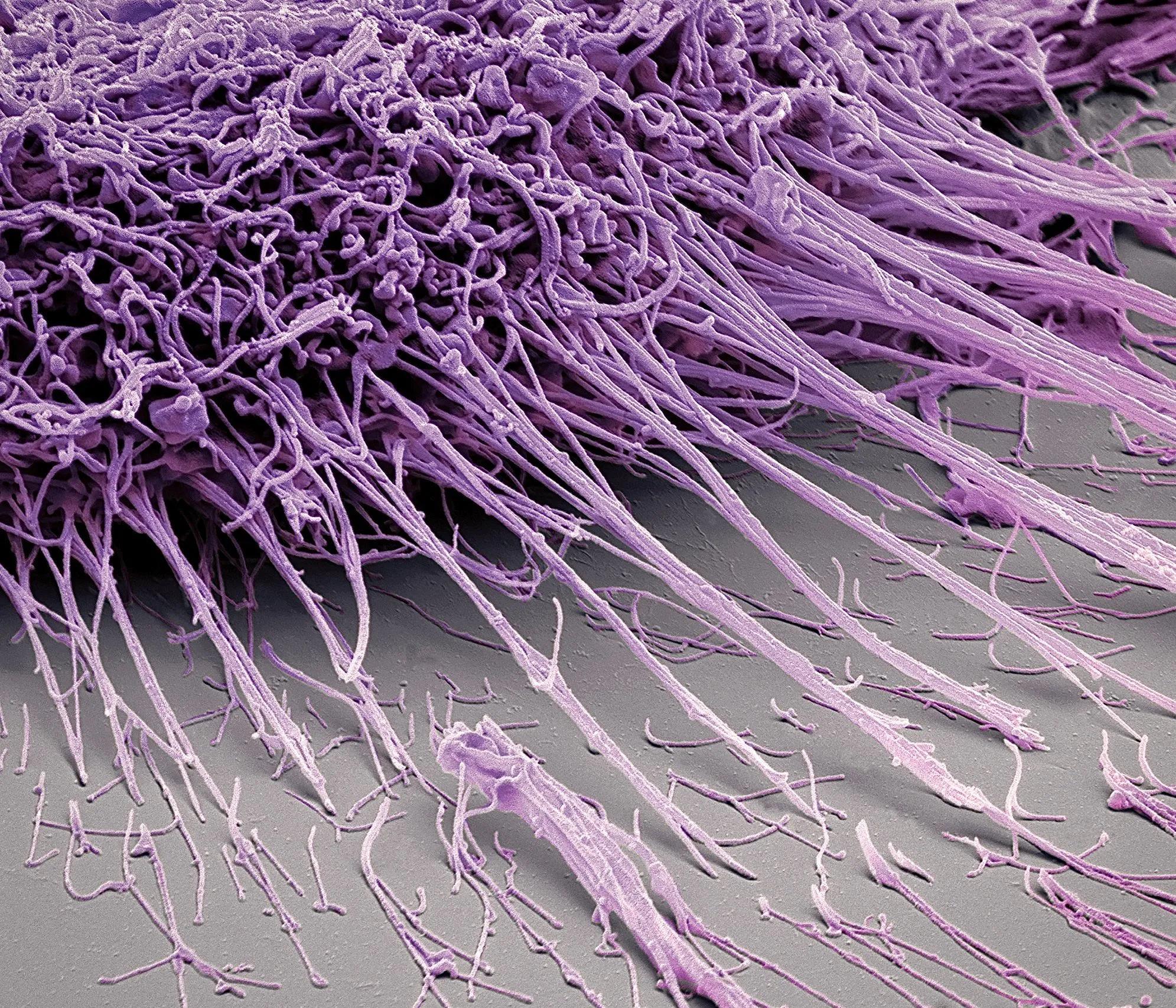 针尖上的细菌,21张电子显微镜下的视图