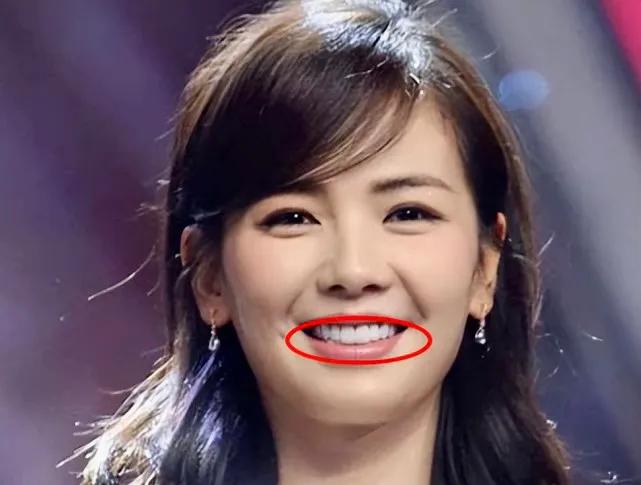 在娱乐圈中有多假，几乎全身任何地方都可以“人造”