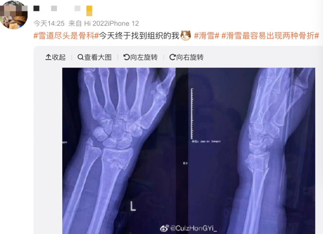 谷爱凌撞脸“港姐”陈凯琳，五官深邃身材高挑，连气质都很相似