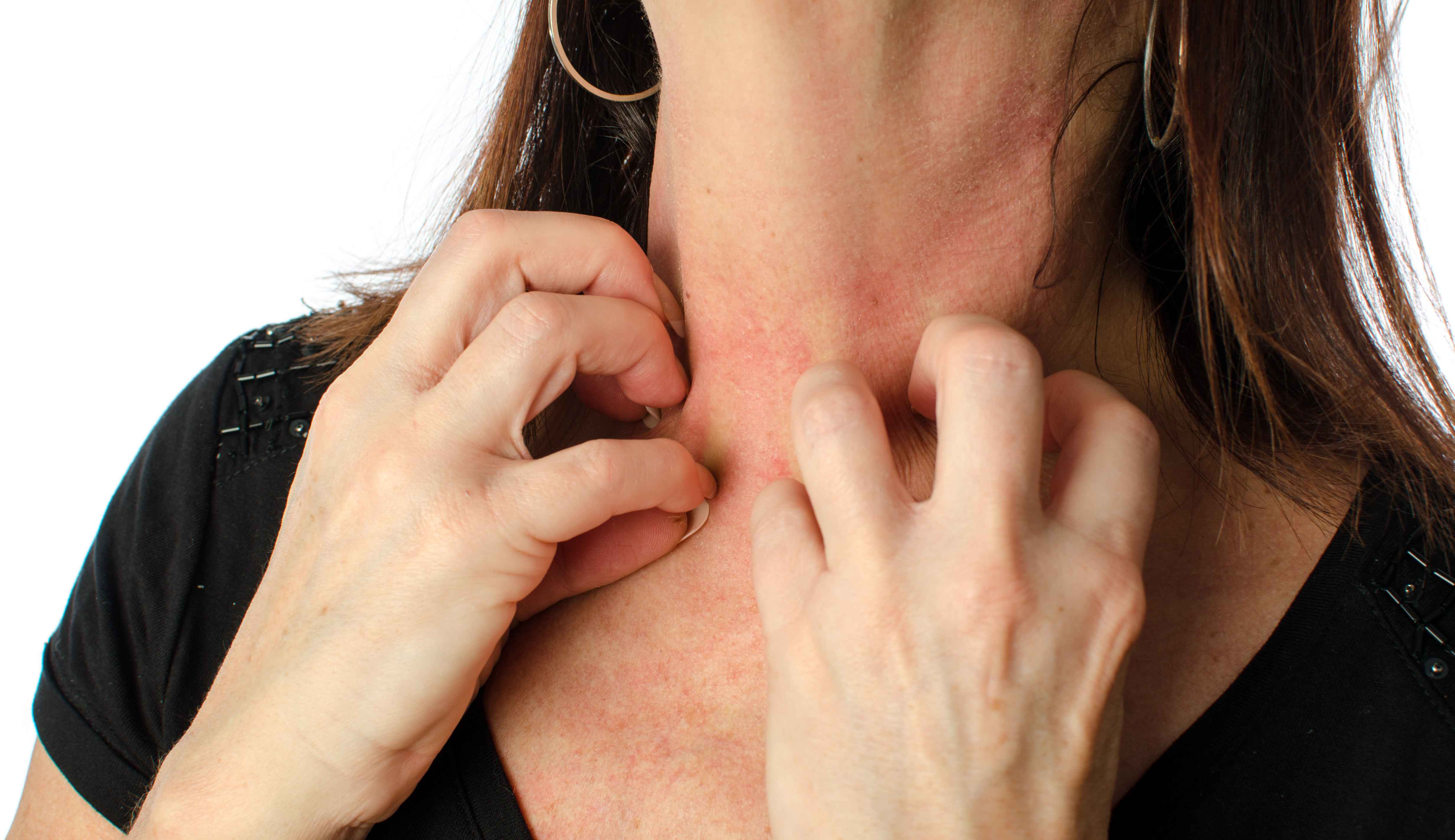 皮肤异常瘙痒，止不住！或与这7种疾病有关，需及时找到病因