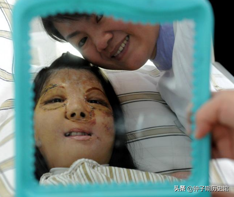 2013年，医生为少女换脸，从被人嫌弃到光彩照人，堪称最强整容术