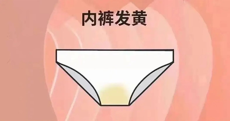 为什么女生的“小内内”会变黄？可能和这几点有关