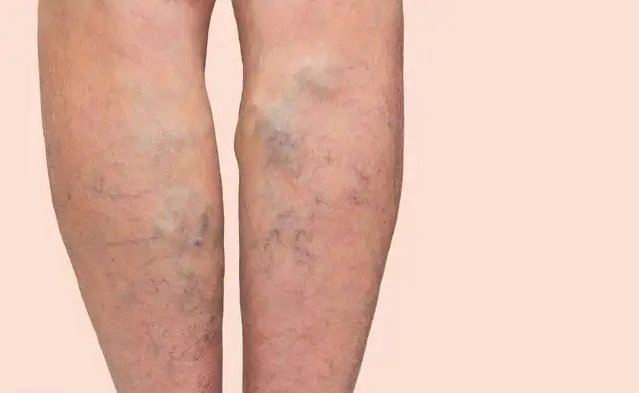 皮肤若是出现4种异常，或是癌症找上门来了，请及时检查