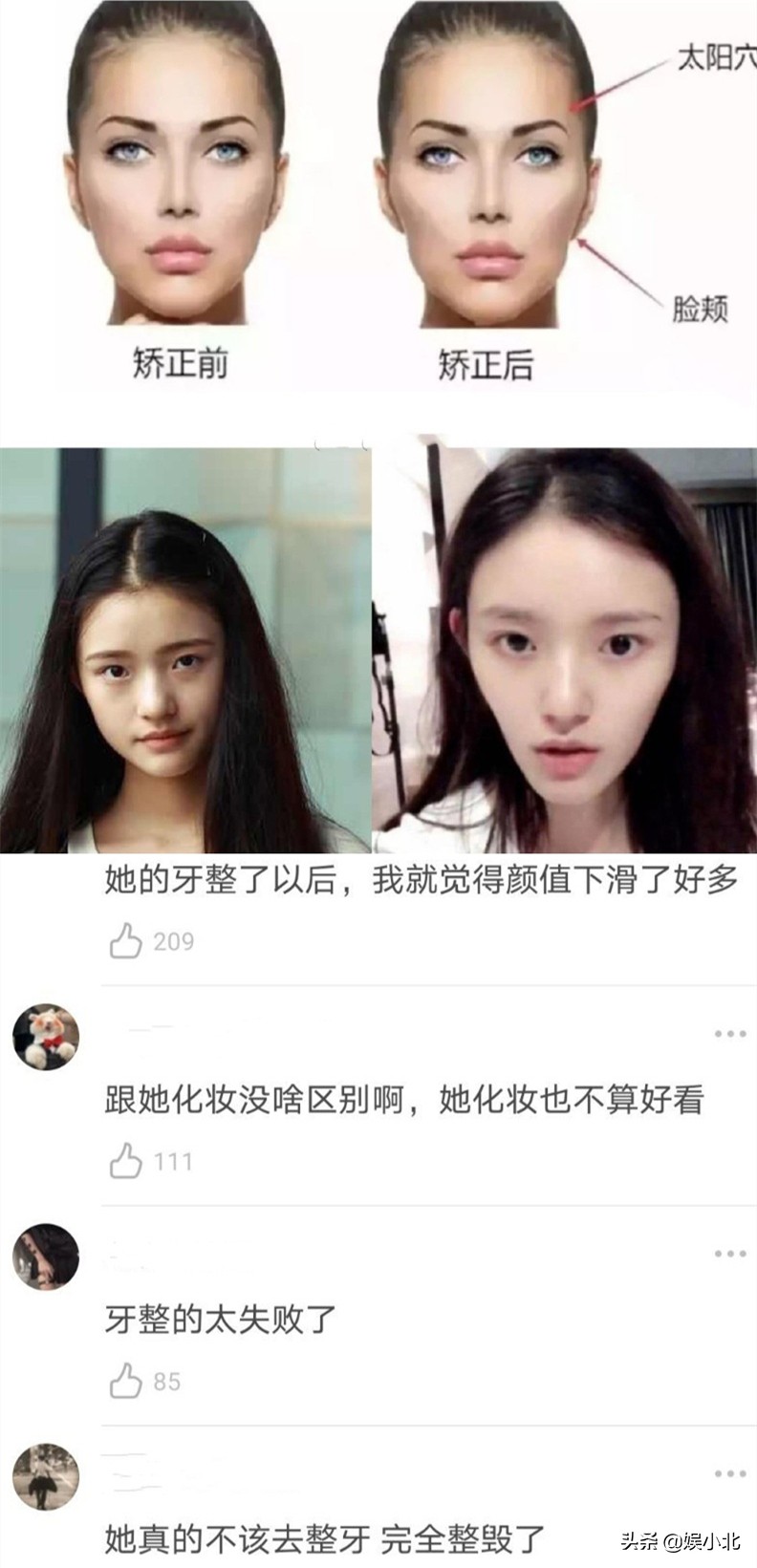 说刘亦菲牙齿丑的，是烤瓷牙看多了吧？