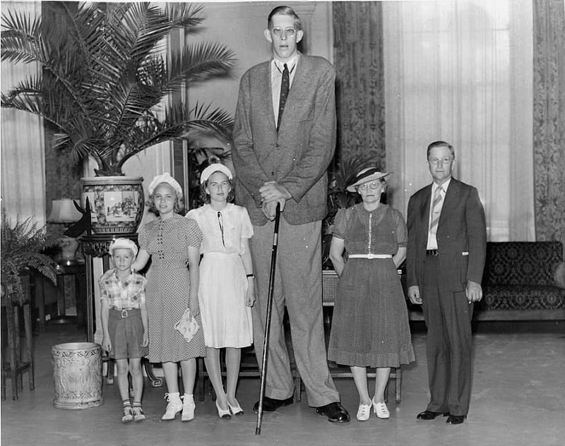 他身高2米72，是世界上最高的人，却只活到22岁，他经历了什么？