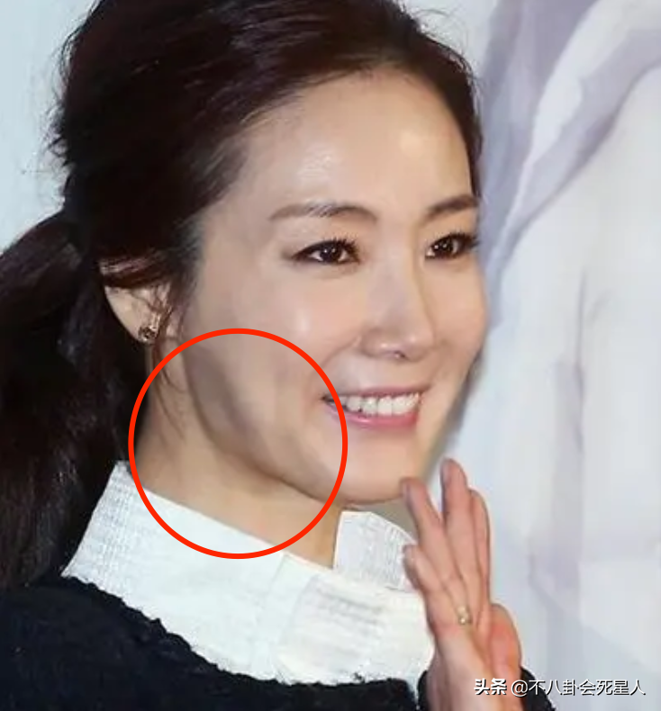 韩国娱乐圈八卦(那些红极一时的韩流明星,终于被整容后遗症给拖累了)