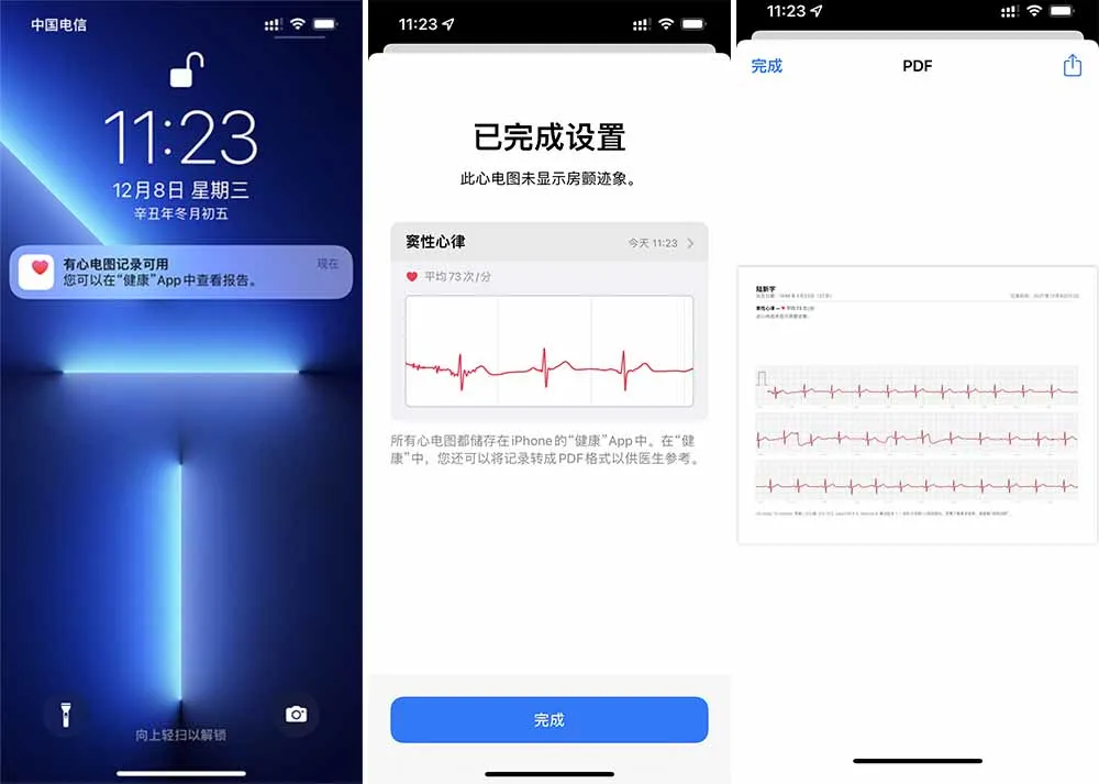 等了 3 年,国行版 Apple Watch 心电图功能终于来了
