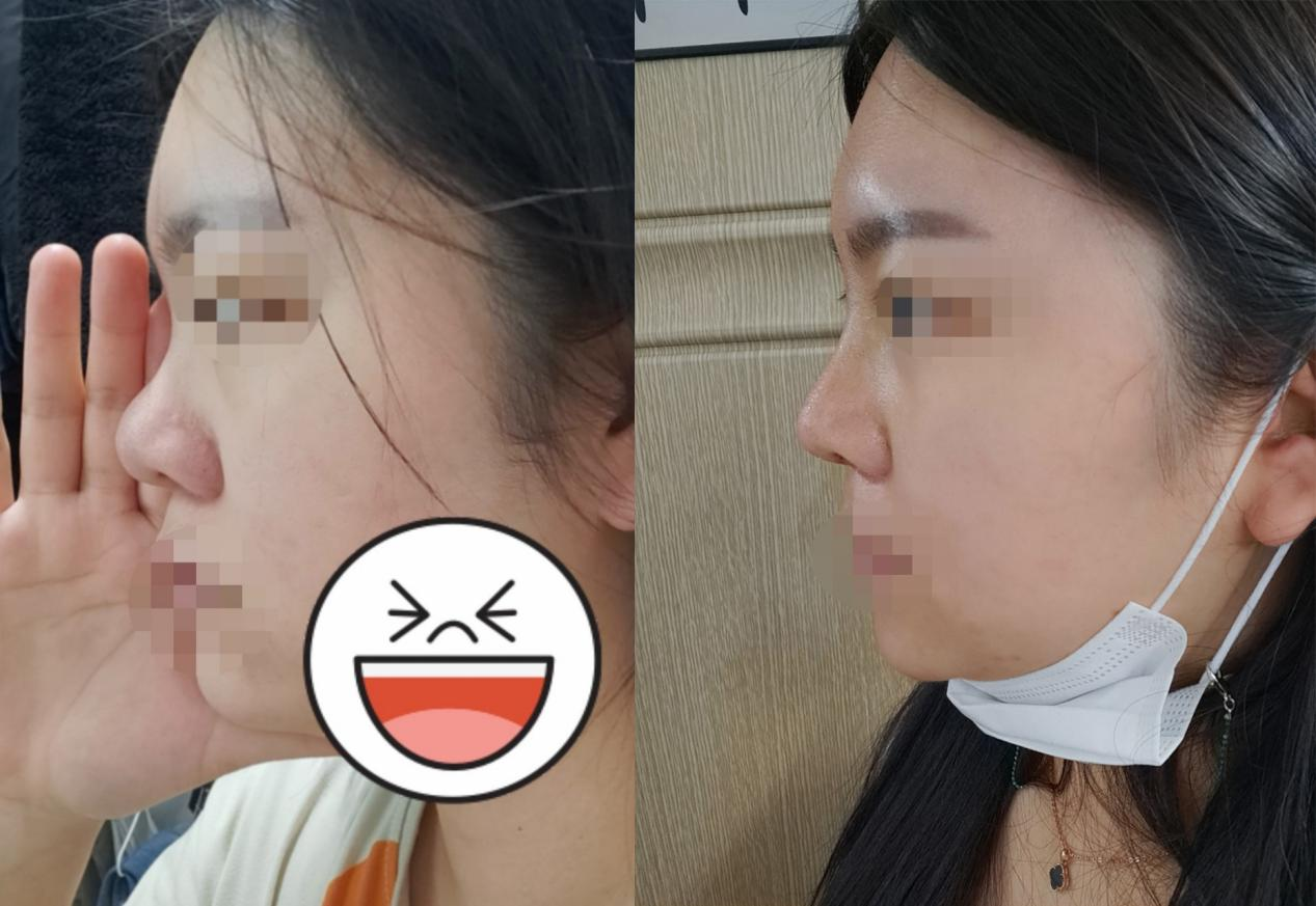 好看的鼻子真的能给你带来好运？38岁女士告诉你真实情况