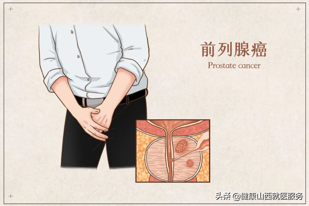尿频、尿急、尿痛别怪肾不好！可能是你的下面生病了