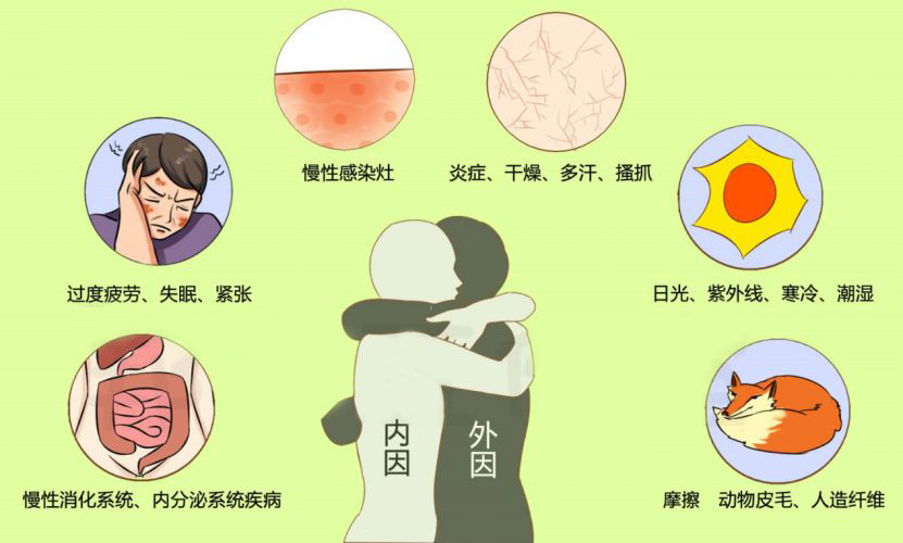 湿疹,难以言说的痒该如何摆脱?