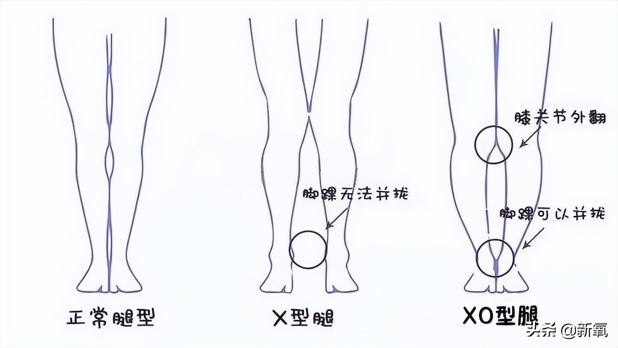 腿长营销翻车我知道，但说她九头身痛失两头真的太好笑了