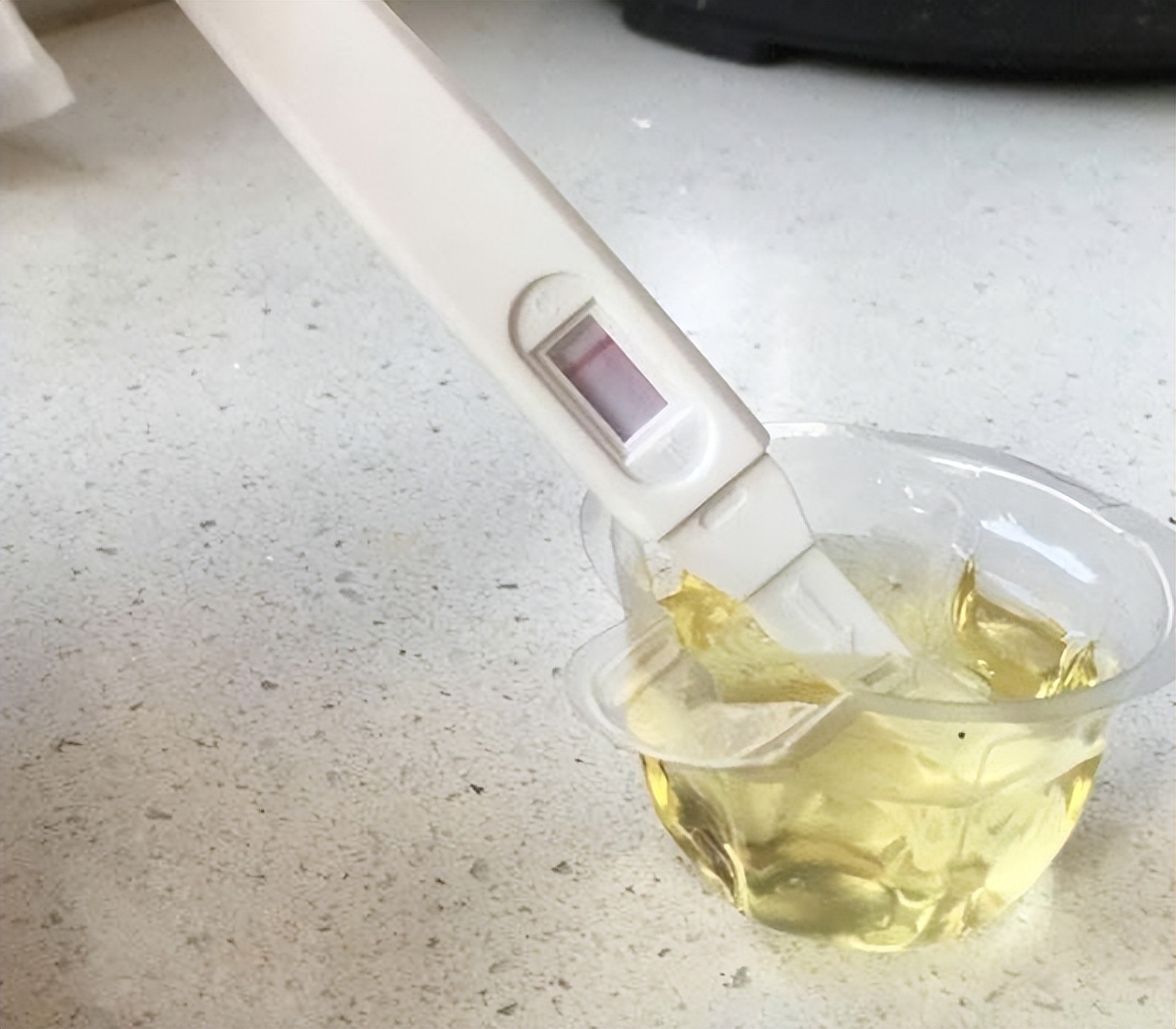 "验尿"也是孕期检查必备的一项,孕妇也要了解清楚