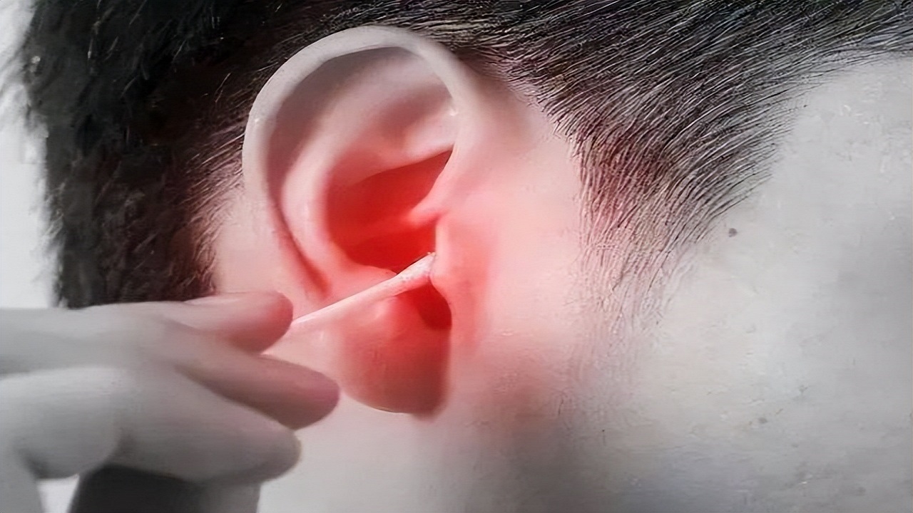 耳朵里面痒，却啥也掏不出来？或是4种病的表现，别光顾着抠了