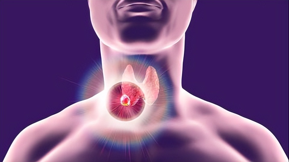 3种蔬菜并不适合甲状腺疾病人群吃，过量或许会助长病情，要避免