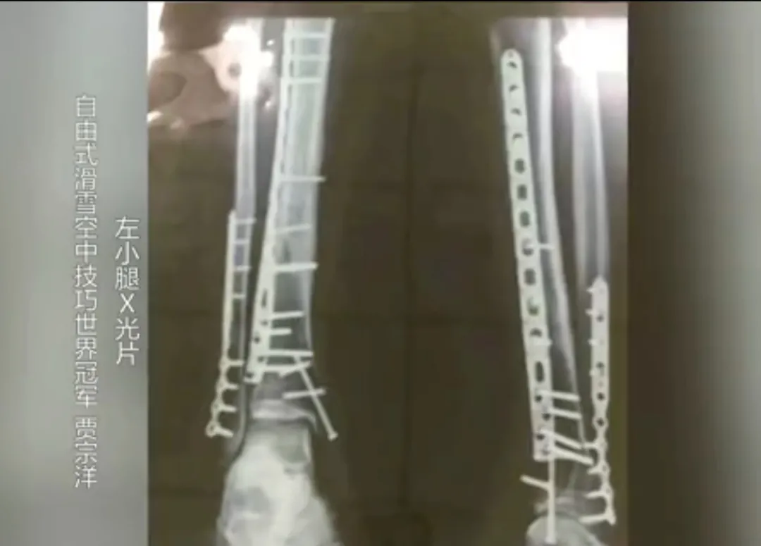 天津连续三天零新增丨中小学开学时间定了!这些人暂不返校丨天津小伙闫文港今日冲金