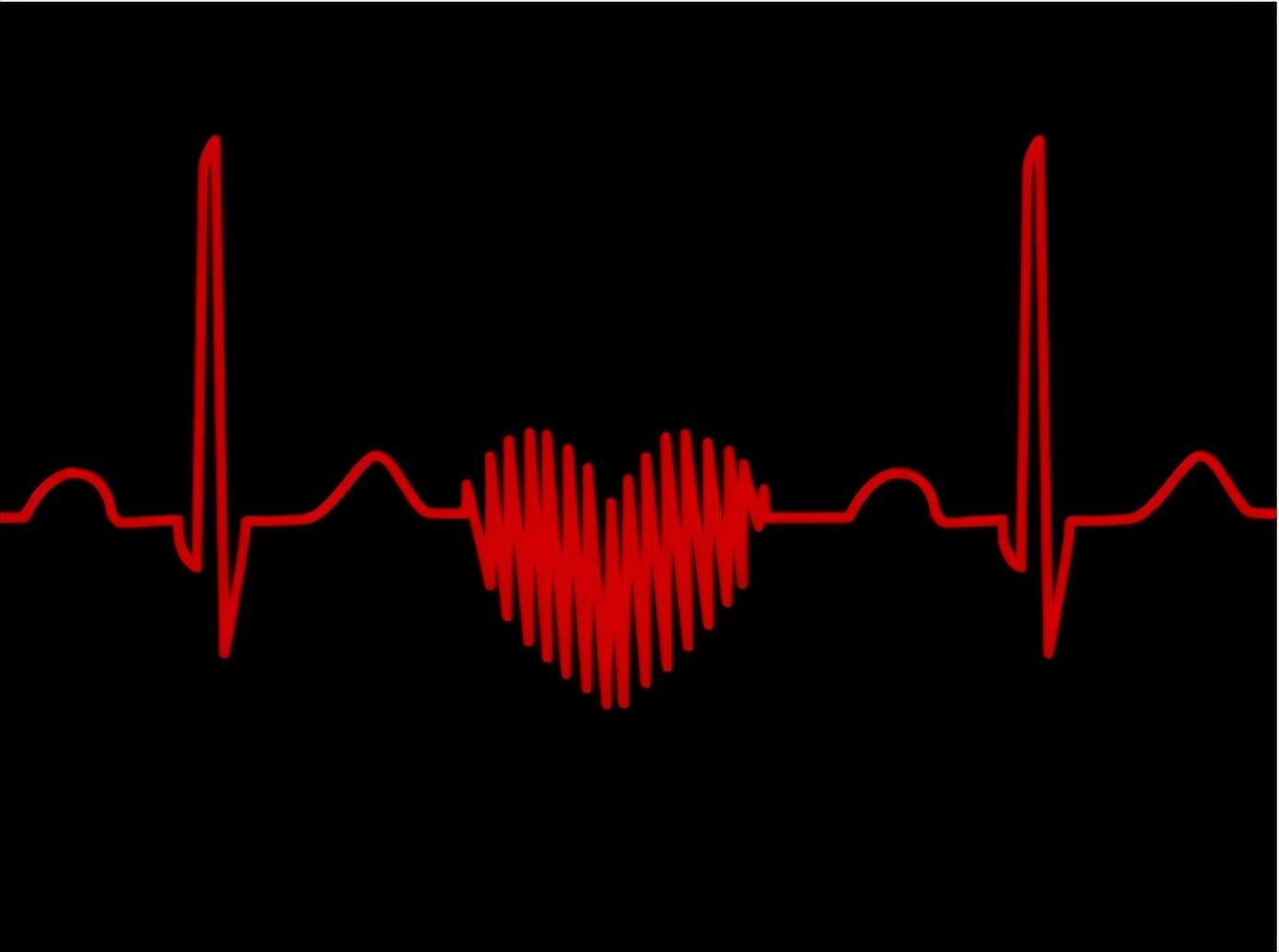 正常人心跳每分钟多少次(心慌气短) - 青木春