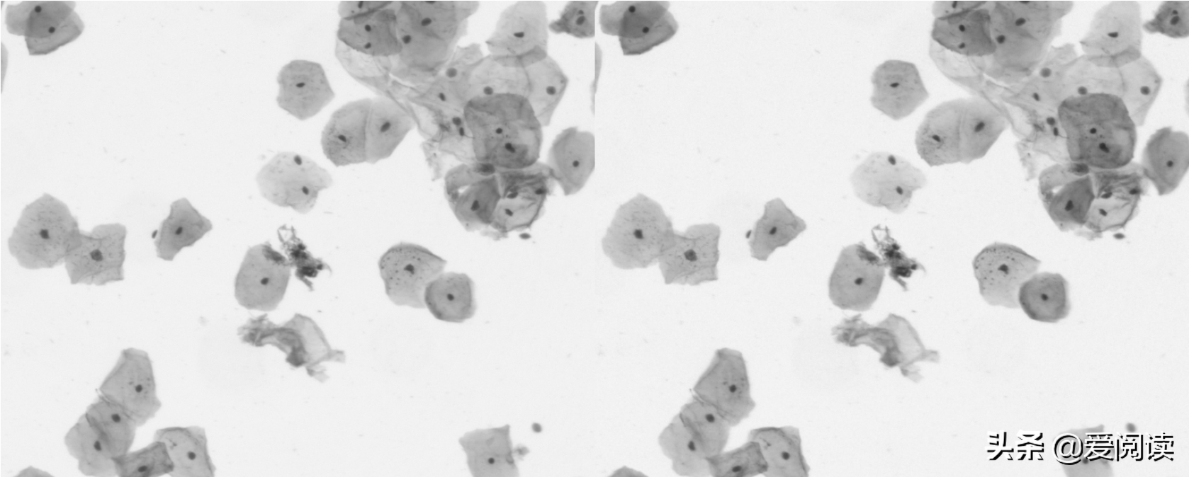 你试过吗？图像（细胞）分割