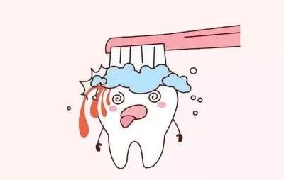「牙齿那些事儿」No.108丨牙周炎治疗需要多久？去除牙菌斑是关键
