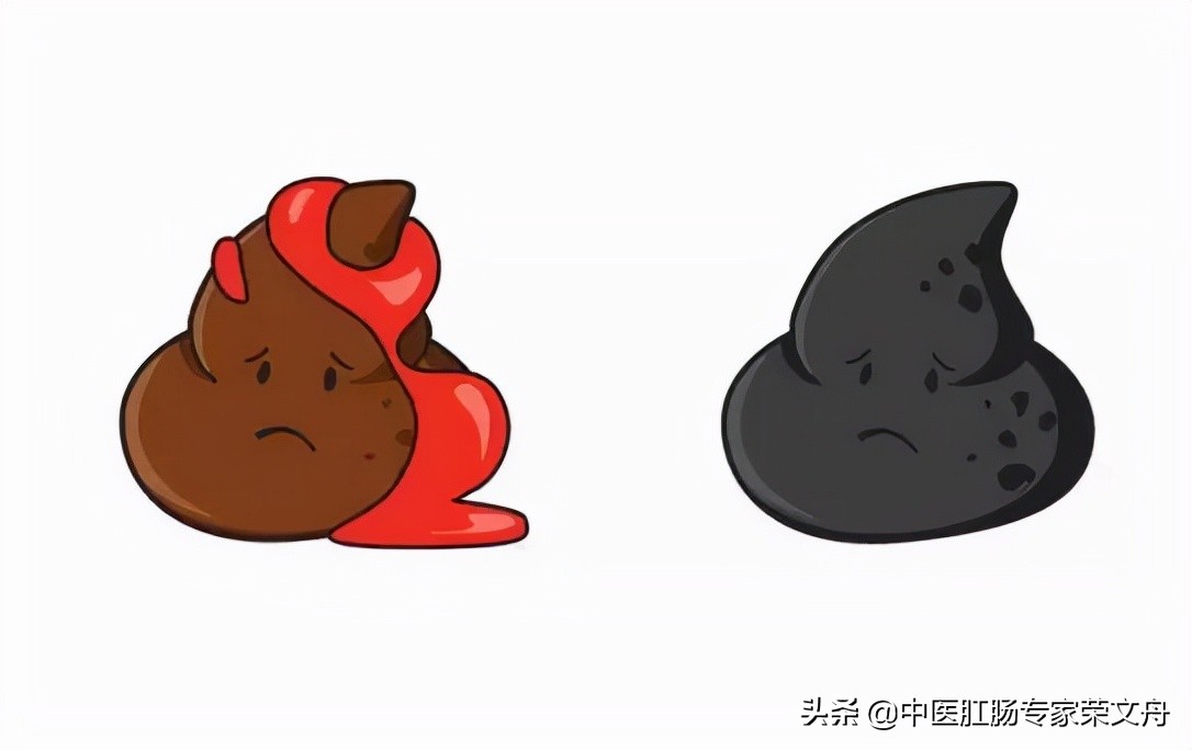 便血却不疼不痒,真的没事吗?答案可能出乎你意料