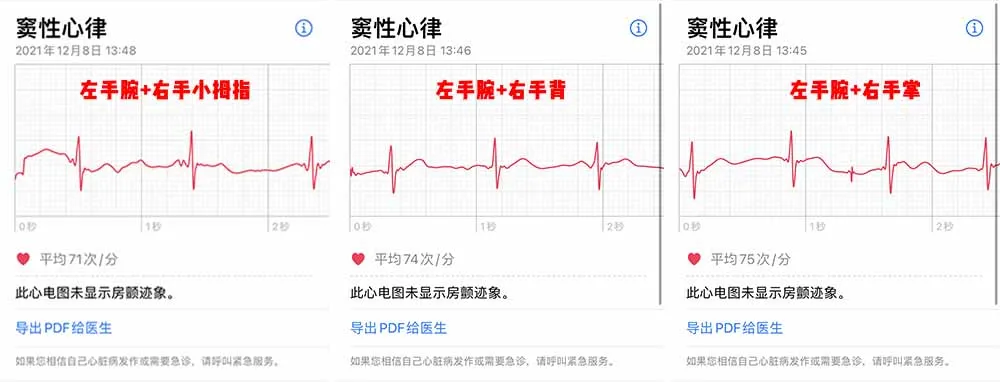 等了 3 年,国行版 Apple Watch 心电图功能终于来了