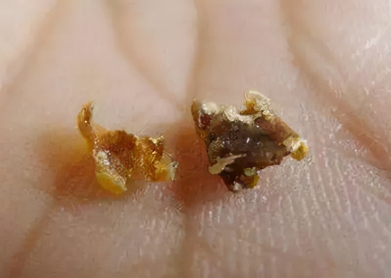 或和这件"尴尬事"有关