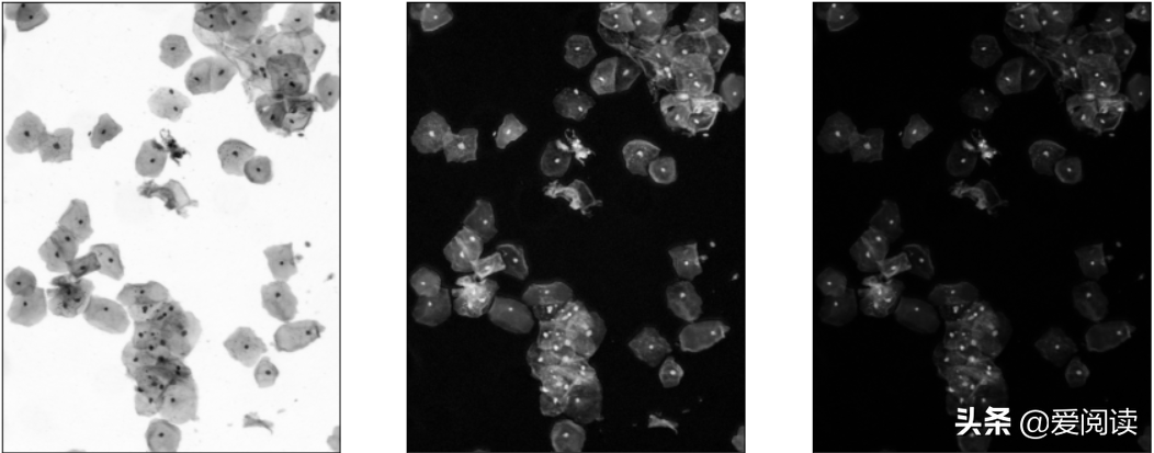 你试过吗？图像（细胞）分割
