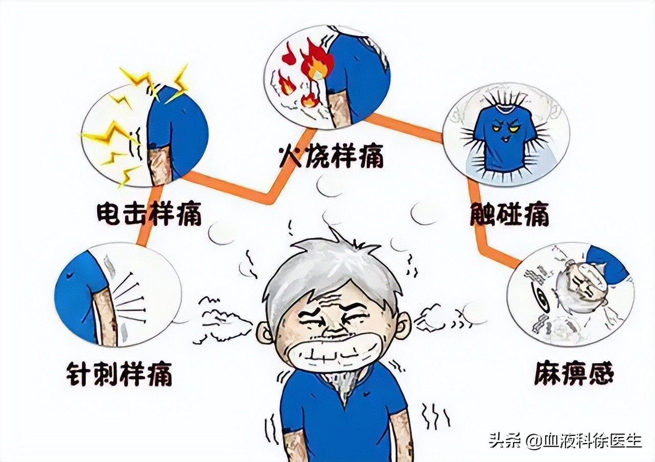 代状疱疹图片大全(有一种剧痛叫) - 赤虎壹号