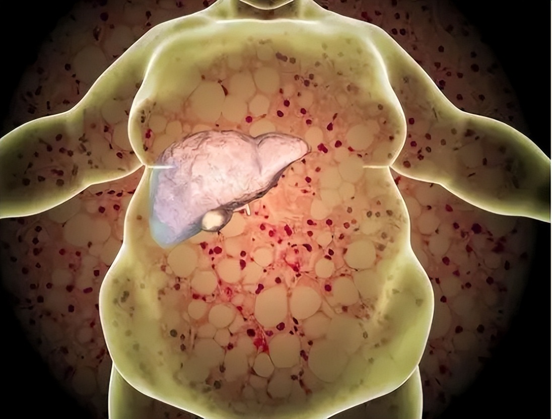 11岁男孩吃出重度肝硬化，这5种“好习惯”，或对孩子不利