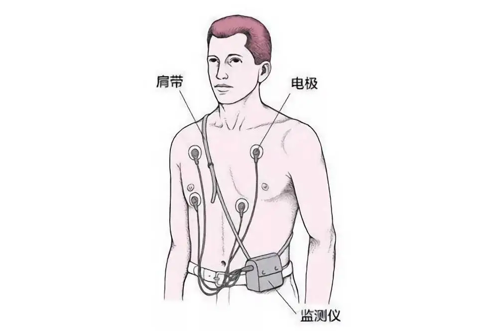 等了 3 年,国行版 Apple Watch 心电图功能终于来了
