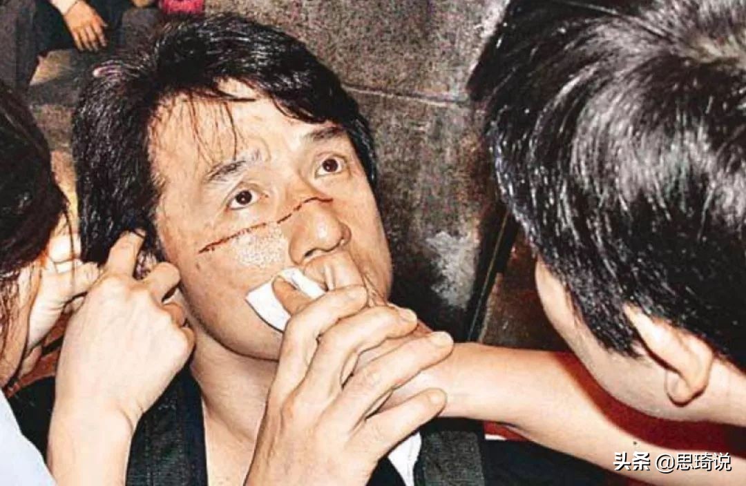 俞灏明的脸、谢霆锋的手、成龙全身是伤，辉煌背后是血泪