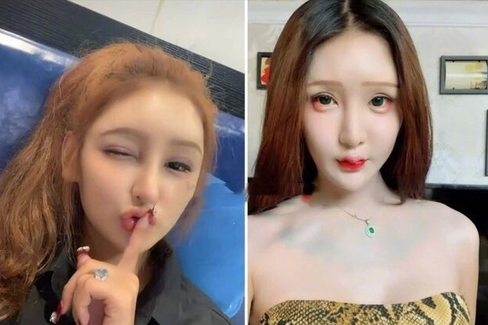 桃花宝宝花上百万整容,前后模样对比太吓人,网友:亲妈都不认识