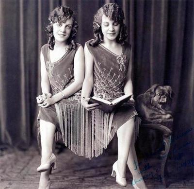 阿比盖尔和布列塔妮(连体人真的存在吗)-图6