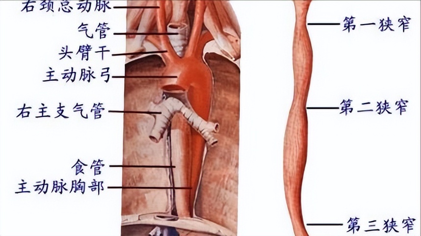 发现新生宝宝嘴里不停冒泡，要注意！可能是先天性食道闭锁