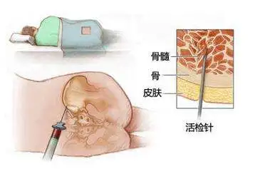 白血病专挑孩子下手，血常规报告上有这3种箭头，要当心